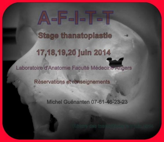 Stage thanatoplastie