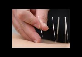 acupuncture et relaxation