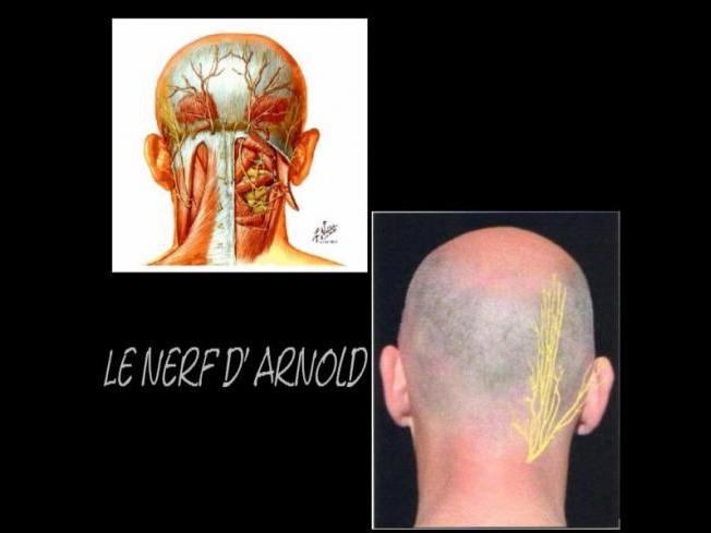 ASSOCIATION POUR LES PERSONNES SOUFFRANT DE LA NÉVRALGIE D'ARNOLD EN ...